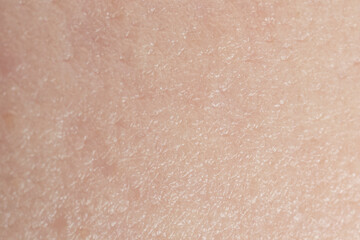 Texture of dry skin as background, macro view