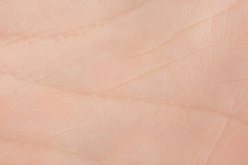 Fototapeta premium Texture of dry skin as background, macro view