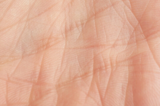 Texture of dry skin as background, macro view