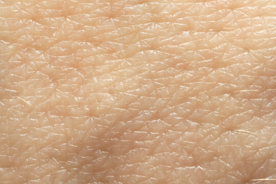 Texture of dry skin as background, macro view