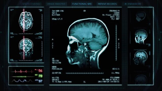 
Medical Profile of Patient Showing Head, Neck and Knee MRI Scan. Vital Signs and Several Healthcare Information. Futuristic Technological Interface Analyzing Human Anatomy.