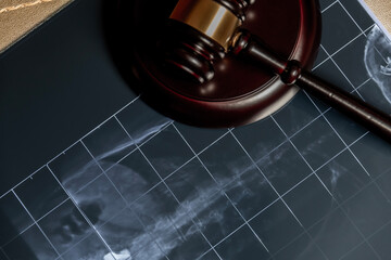 An X-ray under a wooden gavel, suggesting legal issues related to medical procedures or health.
