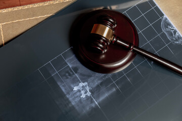 Close-up of a judge's gavel on a medical X-ray film.