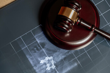 An X-ray under a wooden gavel, suggesting legal issues related to medical procedures or health.