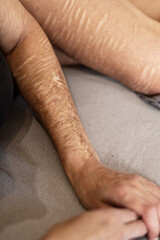 Fototapeta premium arm and leg of a Woman with heavy Cuts and scars of self-mutilation in frustration, self-abusing