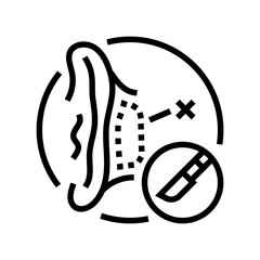 otoplasty surgery line icon vector. otoplasty surgery sign. isolated contour symbol black illustration