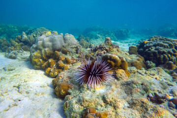 Several sea urchins with white and black spines move their spines merging into a lump at the bottom...