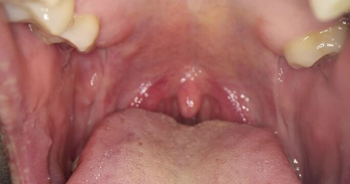 Human open mouth with glands and teeth. Throat examination concept