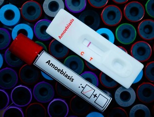 Blood sample of patient negative tested for amoebiasis by rapid diagnostic test.