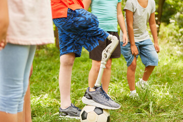 Group of children playing with soccer ball with boy with prosthetic leg