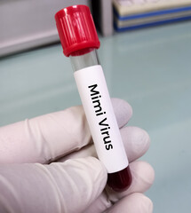 Fototapeta premium Blood sample for Mimivirus test, DNA virus, agent of human respiratory disease, biggest virus, focus view.