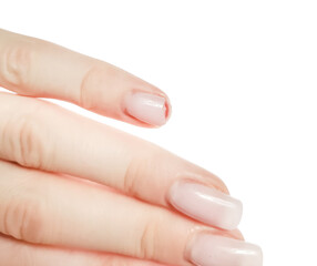 Broken nail on a woman's hand white background. damaged extended nail