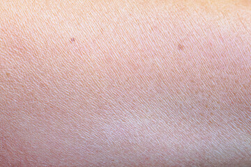 dry and dehydrated human skin texture background