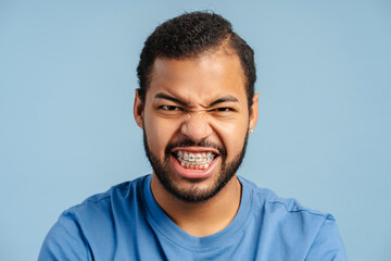 Expressive African American man with braces, grimacing with rage and looking at the camera