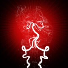 Obraz premium CT angiography of the brain or CTA brain showing noraml cerebral artery.