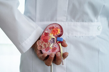 Chronic kidney disease, doctor with model for treatment urinary system, urology, Estimated...