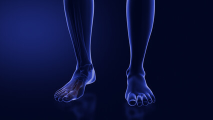 Ball of foot pain or Metatarsalgia - obrazy, fototapety, plakaty