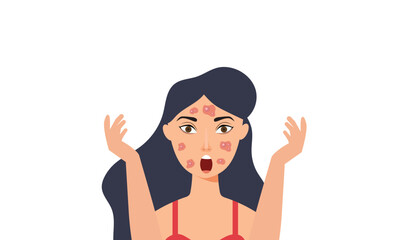 Obraz premium A young girl has skin problems with acne, Vitiligo skin and allergic pimples on her face. Skincare and dermatology concepts. Flat style vector illustration.