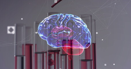 Image of human brain over laboratory dishes on grey background