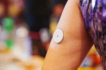 Sugar monitoring sensor on the shoulder. An insulin pump.
