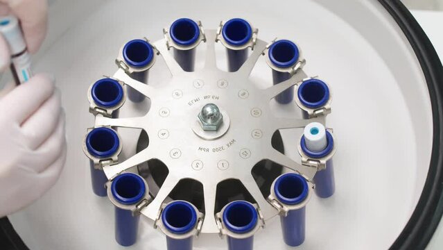 Close-up of a centrifuge with blood plasma in a cosmetology center for aesthetic cosmetology. PRP therapy treatment in a beauty clinic. Treatment of problem skin.