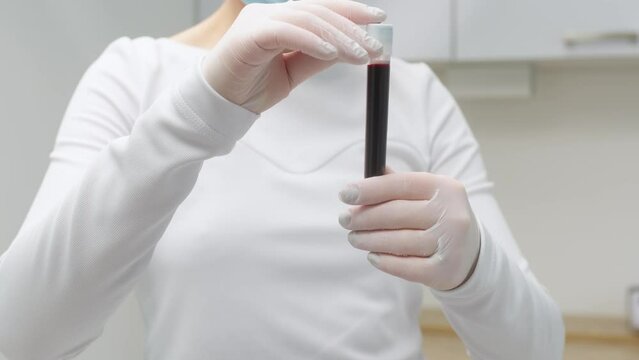 A cosmetologist in a white coat and gloves checks and demonstrates a blood collection tube with centrifuged blood - separated rich in platelets and plasma