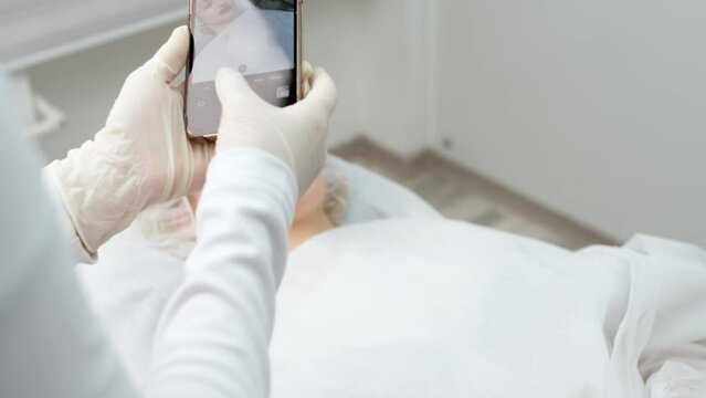 Medical office, a female doctor takes a photograph of a patient on the phone, after injections of hyaluronic acid, facial correction and cosmetology.