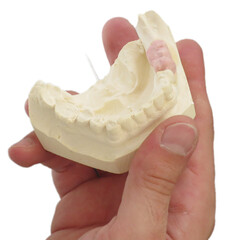 dental laboratory dental prostheses
