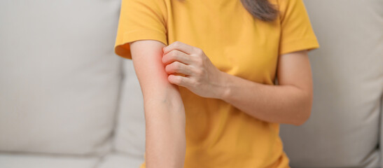woman itching and scratching itchy arm. Sensitive Skin Allergic reaction to insect bite, food, drug...