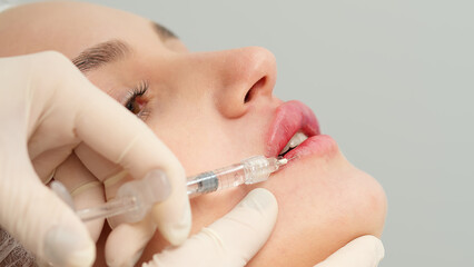 Injection procedure for lip augmentation, close-up. The cosmetologist slowly and carefully injects...