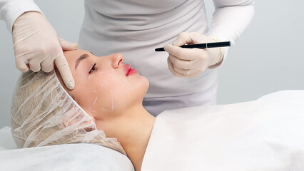 A master performs a lip augmentation procedure on a woman in a beauty salon in a beauty salon. Before the procedure, he makes corrections with a marker. Concept of cosmetology, surgery and injections.