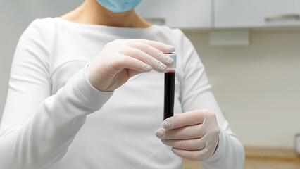 A cosmetologist in a white coat and gloves checks and demonstrates a blood collection tube with...