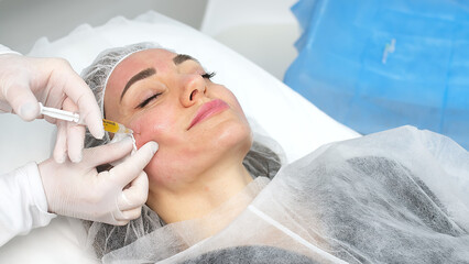 Medical cosmetology of plasma injections. Cosmetology, facial injections close-up. A professional...