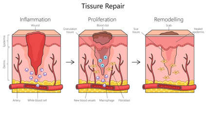 Tissue repair structure diagram hand drawn schematic vector illustration. Medical science educational illustration - obrazy, fototapety, plakaty