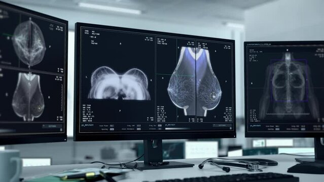 Screening diagnostic x-ray technology used at the healthcare centre. X-ray screening diagnostic of the female breasts. X-ray mammography screening diagnostic detects cancer cells in the breasts.
