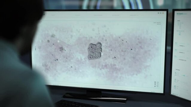 Medical software is analyzing the molecules of human infection. A Doctor is controlling the research process of human infection molecules. Human inflection molecules are studied under the microscope.