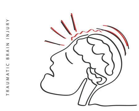Hand drawn line art depicting Brain Injury. Traumatic Brain Injury Awareness flashcard. Concussion and Brain structure damage.