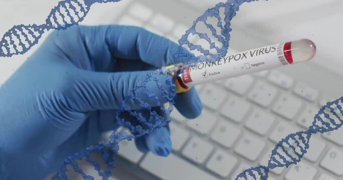 Animation of blue dna strands over gloved hand holding monkey pox blood sample test tube