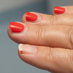 Damaged Nails with Chipped Red Polish on Woman's Hand
