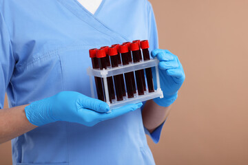 Laboratory testing. Doctor with blood samples in tubes on light brown background, closeup