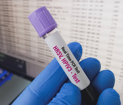 Blood sample for rt-PCR HRSV (Human respiratory syncytial virus), and HPIV3 (Human Parainfluenza Virus-3) test. to diagnosis of acute lower respiratory tract infections (ALRTIs).