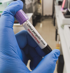 Blood sample for Lishui Pangolin Virus RT-PCR test.
