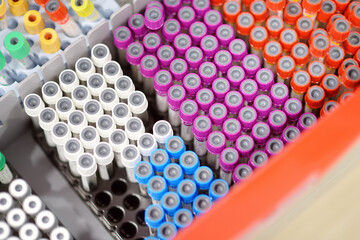 Top view of a lot of test blood tubes in laboratory of clinic or hospital. Textures and backgrounds for medicine