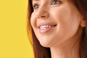 Obraz premium Young woman with dental braces on yellow background, closeup