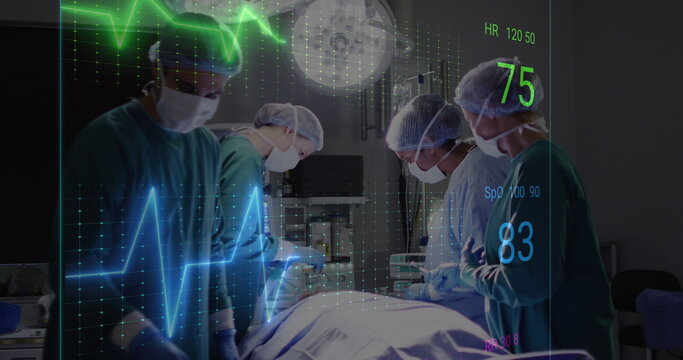 Image of cardiograph over diverse surgeons operating on patient at hospital - Powered by Adobe