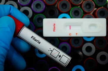 Blood sample of patient negative tested for filaria by rapid diagnostic test.