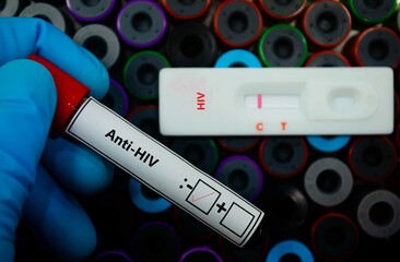 Obraz premium Blood sample of patient negative tested for anti-HIV by rapid diagnostic test.