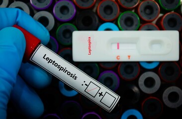 Blood sample of patient negative tested for leptospirosis by rapid diagnostic test.