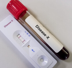 Blood sample and rapid test device for Disease X test. Disease X is the mysterious name given to...
