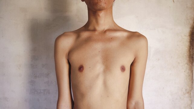 thin male body shape